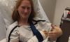 Alison Van Uytvanck operata al braccio destro