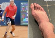 Arthur Cazaux, infortunio alla caviglia: fuori da Madrid e Roma, Roland Garros a rischio