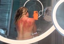 Zarazua mette in guardia dalle condizioni estreme: “Il sole australiano non scherza”